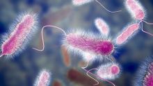 Prevention of Legionella bacteria infection